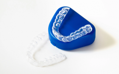 O que são os alinhadores dentários?