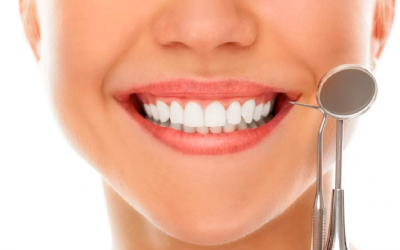 Que cuidados devo ter após o branqueamento dentário?