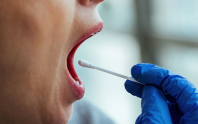 Cancro Oral